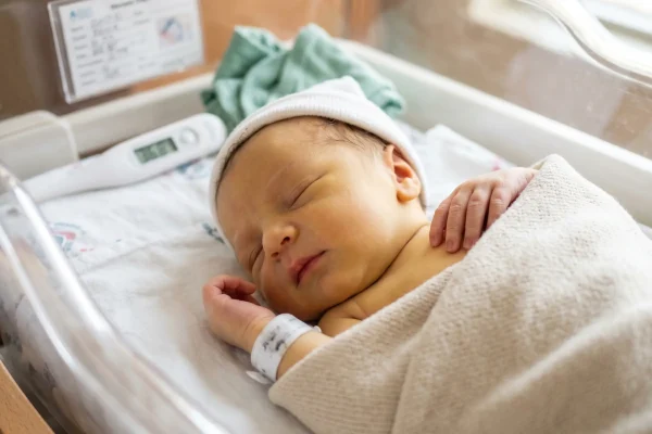 Icterícia neonatal o que é e sinais de alerta